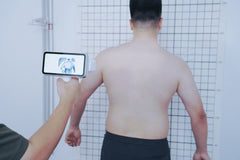 EinScan Medixa