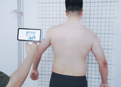 EinScan Medixa movement compensation for patient scanning